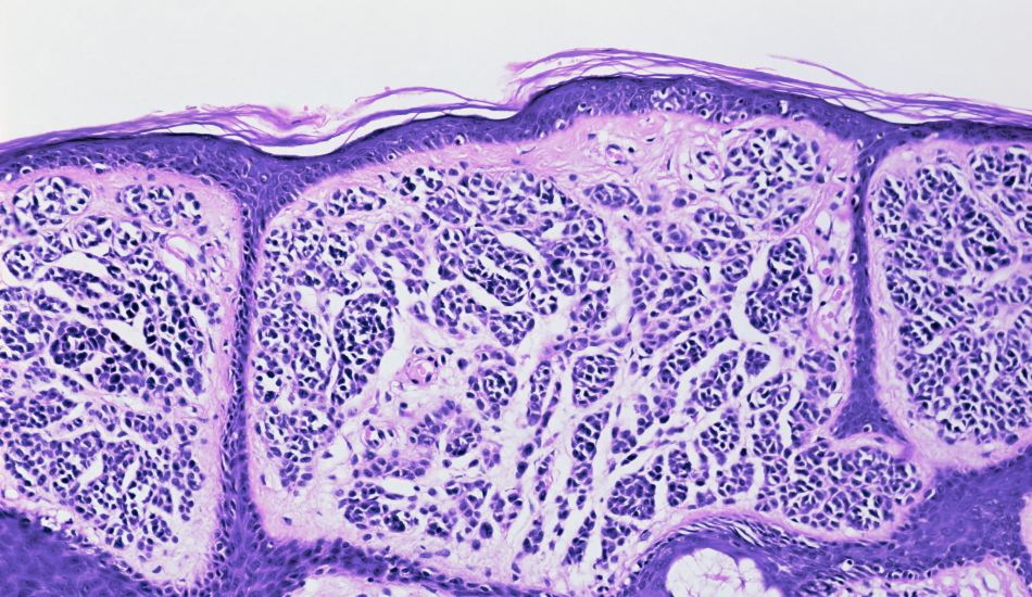 Close up of skin cells