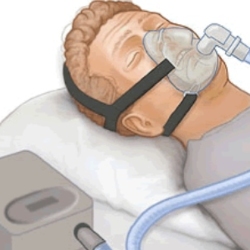 Drawing of someone using Continuous Positive Airway Pressure (CPAP) therapy