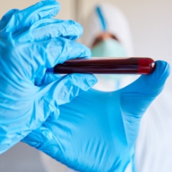 Gloved hand holding vial of blood.