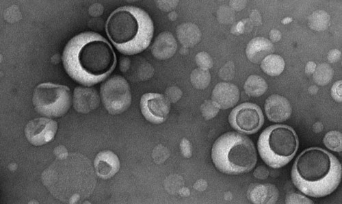 Liposomes under the electron microscope