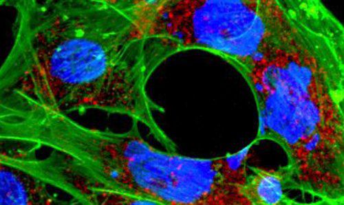 cancer cell